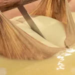 Käsebruch geschnitten